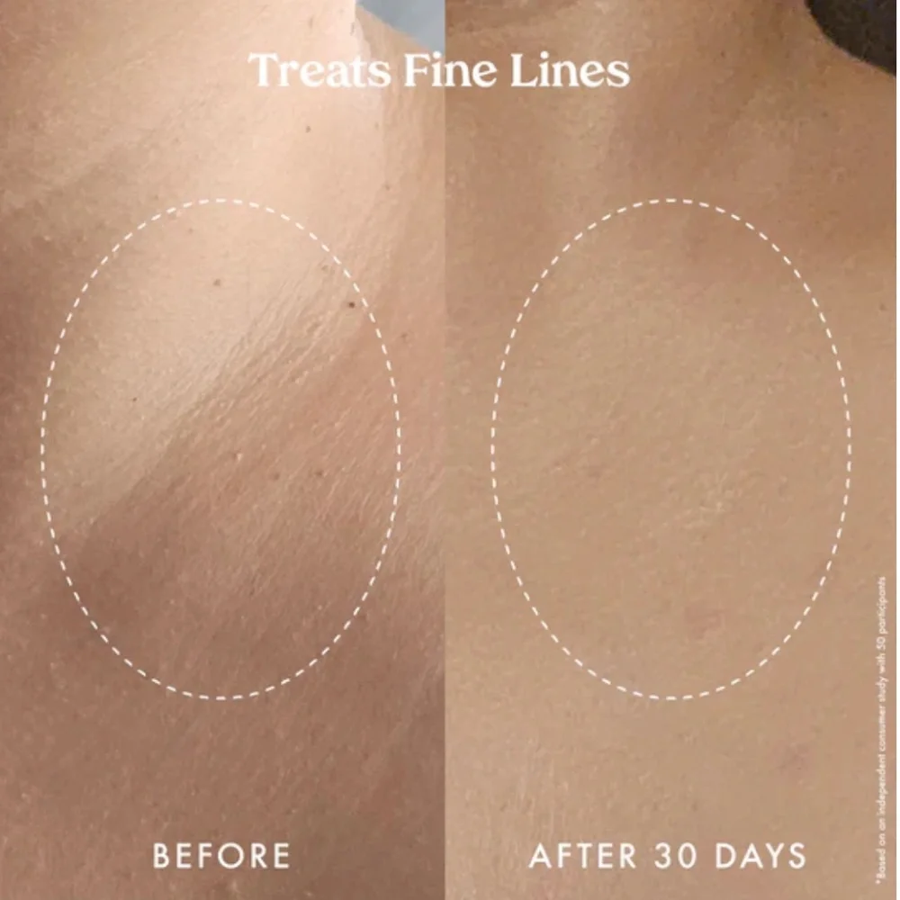 KOPARI Time Rewind Smoothing Body Set with BAG - Picture 11 of 16